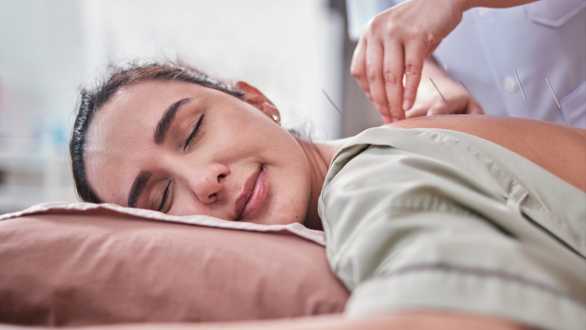 Woman laying on her stomach receiving acupuncture